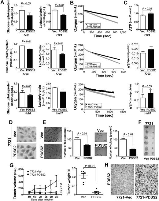Figure 3. PDSS2 inhibited aerobic glycolysis and tumorigenicity. Reintroduction of PDSS2 could decrease glucose uptake and lactate secretion (A) and increase oxygen consumption (B) and the ATP level (C) compared with that in control cells. D, IHC staining confirmed the expression of ectopic PDSS2 in 7,721 cells (original magnification, ×200). E, The representative pictures and summary of the foci formation assay (left) and the colony formation assay in soft agar (right) demonstrated that the anchorage-dependent and anchorage-independent growth ability was inhibited in 7721-PDSS2 cells compared with those in control cells (7721-Vec). F–H, An in vivo tumor formation assay demonstrated that PDSS2 could inhibit tumor growth in nude mice. Compared with tumors induced by 7721-Vec cells (n = 6), tumors induced by 7721-PDSS2 cells (n = 6) showed a smaller size (F), slower growth rate and lower tumor weight (G) 5 weeks after subcutaneous injection. H, Representative images of xenograft sections stained with PDSS2 antibody (original magnification, ×200).