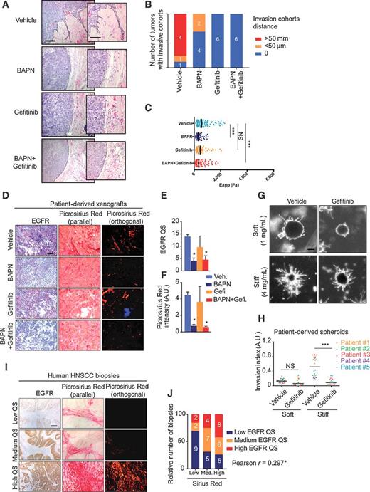 Figure 2. Matrix stiffness and EGFR cooperate to promote collective invasion in vivo. A, Representative hematoxylin and eosin pictures of human patient–derived HNSCC tumors showing collective invasion in control, BAPN, gefitinib or BAPN, and gefitinib-treated group mice. Scale bar, 200 μm. B, Quantification of tumors presenting invading cell cohorts shown in A (n = 6 tumors/group). C, Atomic force microscopy quantification of tissue rigidity (in Pascal) from tumor shown in A. Median quantification was performed on 3 to 5 anatomic regions from frozen sections of three independent tumors for each group. Outliners data points above 2,500 Pa were removed for quantification. D, Representative picture of EGFR immunostaining and Sirius Red–stained collagen bundles observed under polarized light of PDX. Scale bar, 200 μm. E, Quantification of EGFR expression shown in D [Quick Score (QS) method, n = 2 for 3 individual PDXs; mean + SEM]. F, Quantification of fibrilar collagen shown in D. (n = 2 for 3 individual PDXs; mean + SEM). G, Representative pictures of human patient–derived HNSCC multicellular spheroids embedded in soft or stiff matrices in the presence or absence of gefitinib (5 μmol/L). Scale bar, 200 μm. H, Quantification of HNSCC multicellular spheroid invasion shown in G (n = 5 for 5 individual patients; bars correspond to mean). I, Representative picture of EGFR expression (measured by the Quick Score method) and collagen fibrilar deposition in a cohort of 48 patients with HNSCC (scale bar, 200 μm), classify between low (QS ≤ 8), medium (8 < QS ≤ 12), and high (12 < QS) EGFR expression. J, Relative number of patient biopsies (shown in I) classified between EGFR QS and Sirius Red intensity. White numbers represent the real number of biopsies per conditions. A Pearson correlation was performed. For all data, paired samples were compared by two-tailed Student t test, whereas one-way ANOVA and post hoc Tukey tests were used for group comparisons (NS, not significant; *, P < 0.05; ***, P < 0.001). A.U., arbitrary unit.