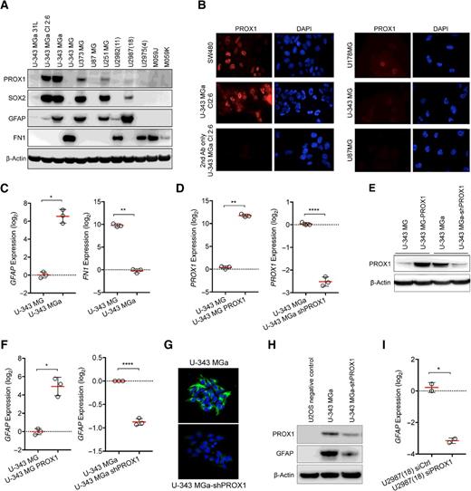 Figure 2. Expression analysis of PROX1 in different glioma sample collections and generation of stable cell lines to assess PROX1 function in glioblastoma. A, Screening of glioma cell lines for PROX1, as well as SOX2, GFAP, and FN1 protein levels. Immunoblot of β-actin protein was used as loading control. B, PROX1 protein was detected by immunofluorescence staining in U-343 MGa Cl2:6, indicating a nuclear localization, whereas in U-343 MG and U87MG the signal was undetectable. Colorectal cancer cell line SW480 was used as a positive control for PROX1 staining. C, Comparisons of endogenous GFAP and FN1 transcript levels in U-343 MG and U-343 MGa clones. D, Analysis of PROX1 mRNA levels in U-343 MG-PROX1 and U-343 MGa-shPROX1 as determined by qRT-PCR. E, Analysis of PROX1 protein levels in U-343 MG-PROX1 and U-343 MGa-shPROX1, as determined by immunoblotting. F, qRT-PCR analysis indicating enhanced GFAP mRNA expression in U-343 MG-PROX1 line as compared with U-343 MG and suppression of PROX1 in U-343 MGa-shPROX1 cells. G, Immunofluorescence staining of GFAP (green) in U-343 MGa-shPROX1 cells shows a reduction of the protein. Cell nuclei were stained using DAPI (blue). H, Immunoblots indicating decreased GFAP protein in U-343 MGa-shPROX1 as compared with U-343 MGa, where U2-OS lysate was used as negative control. I, qRT-PCR data indicating a decline in expression of GFAP mRNA in U2987(18) cultures transiently transfected with siPROX1 oligomers. All gene expression analyses were normalized to GAPDH.