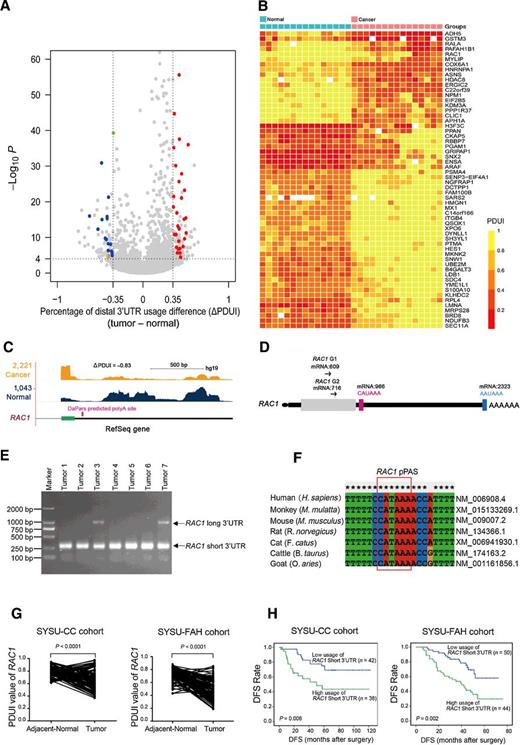Figure 1. 3′UTR shortening of RAC1 identified by DaPars analysis on RNA-seq. A, Fifty-eight significant and reproducible 3′UTR alteration events were identified by DaPars from RNA-seq on 15 UCB and paired adjacent normal bladder tissues. Volcano plot compares ΔPDUI values for UCB tissues versus adjacent normal bladder tissues. Positive values on the x-axis indicate 3′UTR lengthening in tumor tissue, whereas negative values indicate 3′UTR shortening events. The statistical significance (-log10P) is shown on the y-axis. Red dots and blue dots represent genes with significant 3′UTR lengthening or shortening in UCB tissues, respectively. The green dot represents the ΔPDUI value of RAC1, whereas the orange dot represents the ΔPDUI value of RALA. B, Heat map showing the PDUI value of 58 significant and reproducible 3′UTR alterations in genes from 15 UCB tissues (pink group) and matched adjacent normal tissues (blue group). C, Representative RNA-seq density plots along with ΔPDUI values for RAC1 in a UCB tissue (orange plot) and matched normal tissue (blue plot). Numbers on the y-axis indicate RNA-seq read coverage. Schematic representation of the pPAS in RAC1 is shown in the bottom plot. Black, UTR region; green, the protein-coding region (CDS) of RAC1; pink, novel PAS of RAC1. D, Primer sequences used in 3′RACE are indicated on the schematic above the graphs. Gray box, CDS; black box, UTR. The pink box and CAUAAA represent the pPAS identified by 3′RACE; the blue box and AAUAAA represent the dPAS. E, Agarose gel electrophoresis demonstrates 3′RACE amplification of RAC1 using RNAs extracted from seven UCB tissues as templates. Lane 1, marker; lanes 2–8, 3′RACE RAC1 fragment amplified from seven UCB tissues with G2 and inner primers. F, DNA sequence alignment of the pPAS region of RAC1 from seven different mammalian species using MEGA6 software. The pPAS of RAC1 is indicated by the red frame. G, A scatter plot illustrating qRT-PCR analysis of PDUI value for RAC1 in UCB tissues compared with matched adjacent normal bladder tissues from the SYSU-CC (left) and SYSU-FAH (right) cohorts. P < 0.001, paired Student t test. H, Kaplan–Meier curves with univariate analyses of DFS (P < 0.01, log-rank analysis) in patients with UCB with low versus high usage of the RAC1 short 3′UTR from SYSU-CC (left) and SYSU-FAH (right) cohorts.