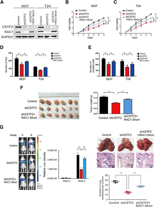 Figure 5. CSTF2 regulates the oncogenicity and invasiveness of the shorter RAC1 isoform in UCB. A, Protein levels of CSTF2 and RAC1 in UCB 5637 and T24 cells after indicated treatment examined by Western blot. GAPDH expression was used as a loading control. B–E, Knockdown of CSTF2 in both 5637 and T24 cells significantly inhibited cell growth (B and C), colony formation (D), and invasion (E), respectively, and such could be largely prevented by ectopic overexpression of short-3′UTR RAC1 isoform in CSTF2-silenced UCB cells (B–E). All graphs represent mean ± SD obtained from three independent experiments. *, P < 0.05; **, P < 0.01, Student t test. F, Xenograft tumor formation in Balb/c nude mice injected with CSTF2-depleted T24 cells was inhibited as compared with that of control cells. Decreased tumor formation was rescued by overexpression of the short-3′UTR RAC1 isoform in CSTF2-silenced cells. Left, images of the xenograft tumors formed in mice. Right, quantification of xenograft tumor weights. *, P < 0.05; **, P < 0.01, Student t test. G, T24 cells infected with the indicated lentiviruses were injected into the vein of Balb/c nude mice, followed by noninvasive bioluminescence imaging for 6 weeks. Representative bioluminescent imaging (left), representative images of lungs (top right), metastatic nodules (arrows) are shown. The lung metastasis in mice injected with CSTF2-silenced T24 cells was significantly suppressed compared with that of control cells, whereas overexpression of the short-3′UTR RAC1 isoform abrogated the effect of CSTF2 depletion on lung metastasis. Middle, hematoxylin and eosin staining of lung metastatic tumors (original magnification, ×100; scale bar, 100 μm). Bottom, number of metastatic nodules formed in the lung of mice is summarized for each tested group (5 mice per group). *, P < 0.05; **, P < 0.01, Student t test.