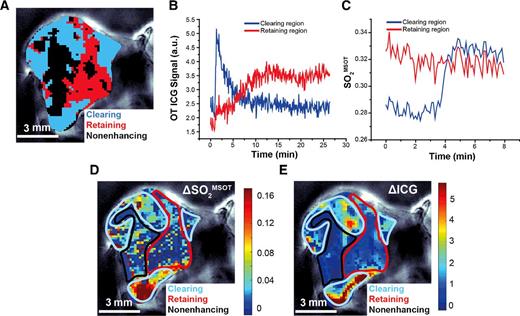 Figure 2. Two distinct classes of DCE kinetics also possess different OE kinetics. Spatially distinct regions were segmented showing ICG clearance or retention (A) following injection, according to the DCE-OT response kinetics (B). The retaining regions show little or no OE-OT response (C), reflecting the poorer vascular function in these areas. Response maps of OE-OT (D) and DCE-OT (E) are also shown, with the clearing, retaining, and nonenhancing regions denoted in light blue, red, and black ROIs, respectively. These further indicate that the strongest OE response occurs in clearing regions, as suggested in C. Data shown are from a representative PC3 tumor. a.u., arbitrary unit.