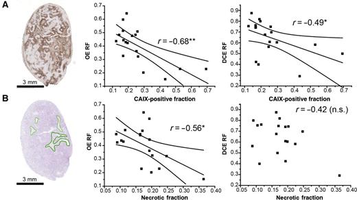 Figure 4. OE-OT is also strongly related to tumor hypoxia and necrosis. A, Representative CAIX-stained sections were used to quantify the extent of tumor hypoxia, to which OE-OT RF shows a strong inverse correlation, whereas the DCE-OT RF shows a weaker relationship. B, H&E-stained sections were used to quantify the extent of tumor necrosis (green line outlines necrotic area), to which OE-OT again showed a strong inverse correlation, whereas DCE-OT response was not significant. Analysis shown from 18 PC3 tumors. n.s., not significant; *, P < 0.05; **, P < 0.01. Line of best fit with 95% confidence intervals is shown in the graphs where significant relationships are identified.