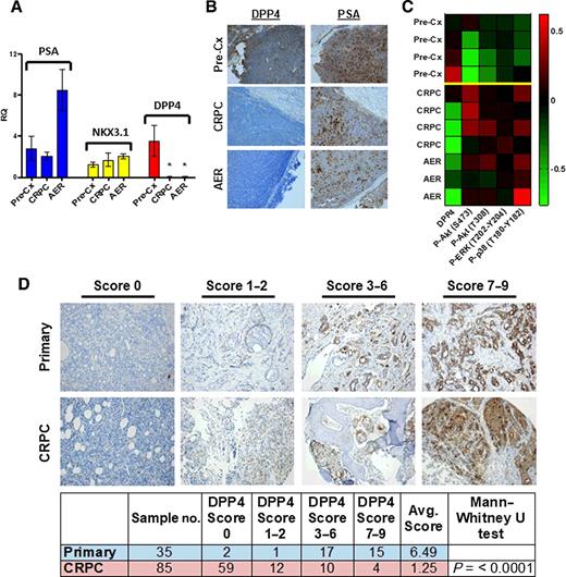 Figure 3. DPP4 expression is decreased in abiraterone/enzalutamide–resistant (AER) and CRPC VCaP xenografts. A, qRT-PCR for PSA, NKX3.1, and DPP4 expression in serial biopsies of VCaP xenografts. Each column represents the expression levels of xenograft tumors from four separate mice, with RT-PCR performed on each in technical triplicate. *, P < 0.03, Mann-Whitney U. RQ, relative quantification. B, Representative images of DPP4 and PSA in serial biopsies of VCaP xenografts. C, Reverse-phase protein array from serial biopsies of four separate VCaP xenografts (see Materials and Methods). D, Representative images of DPP4 IHC and immunoscoring from a series of hormone-naïve primary prostate cancer and CRPC clinical sections. Pre-Cx, precastration.
