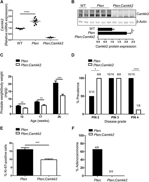 Figure 1. Camkk2 deletion protects against prostate cancer development in the Pten prostate cancer mouse model. A, Camkk2 mRNA from wild-type (WT), Pten, and Pten;Camkk2 prostate of mice aged 17 weeks (n = 5–7 mice per genotype) was determined. Significant difference between WT and Pten-null mice is shown. ****, P < 0.0001. B, Representative Western blot showing Camkk2 expression in prostates from WT, Pten, and Pten;Camkk2 mice aged 17 weeks together with graph of quantification. *, P < 0.05, significant difference in expression between WT and Pten-null samples (n = 5–7 mice per genotype). C, Wet weight of whole prostate relative to bodyweight (n = 7–15 per genotype). **, P < 0.01; ***, P < 0.005, significant differences between genotypes. D, Quantification of pathologic grading from 26-week-old mice. A range of PIN grades were found within a prostate section and so may appear in more than one category (n = 10 for Pten and 8 for Pten;Camkk2 mice). Significant differences using Fisher exact test (two-sided P value) are indicated as *, P < 0.05 and ****, P < 0.0001. E, Percentage of Ki-67–positive cells in prostate sections of 26-week-old mice (n = 3–4 mice for each genotype; 5,000 cells per lobe). ***, P < 0.005, significant differences between genotypes. F, H&E-stained sections from 40-week-old mice were scored for adenocarcinoma (n = 5–6 per genotype). Two-sided P value using Fisher exact test is 0.06.