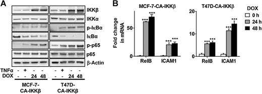 Figure 1. Doxycycline (DOX) treatment activates the NFκB pathway in ER+ breast cancer cell lines expressing CA-IKKβ. A, MCF-7-CA-IKKβ and T47D-CA-IKKβ cells were treated with doxycycline (1 μg/mL) for 24 or 48 hours, or with TNFα (10 ng/mL) for 30 minutes as a positive control. Whole-cell extracts were prepared and expression of IKKβ, IKKα, phospho-IκBα (Ser32), IκBα, phospho-p65 (Ser532), p65, and β-actin was detected by Western blotting. B, MCF-7-CA-IKKβ and T47D-CA-IKKβ cells were treated with doxycycline for 24 or 48 hours. Expression of the NFκB target genes, RelB and ICAM1, was assessed by qPCR (***, P < 0.001 vs. untreated control).