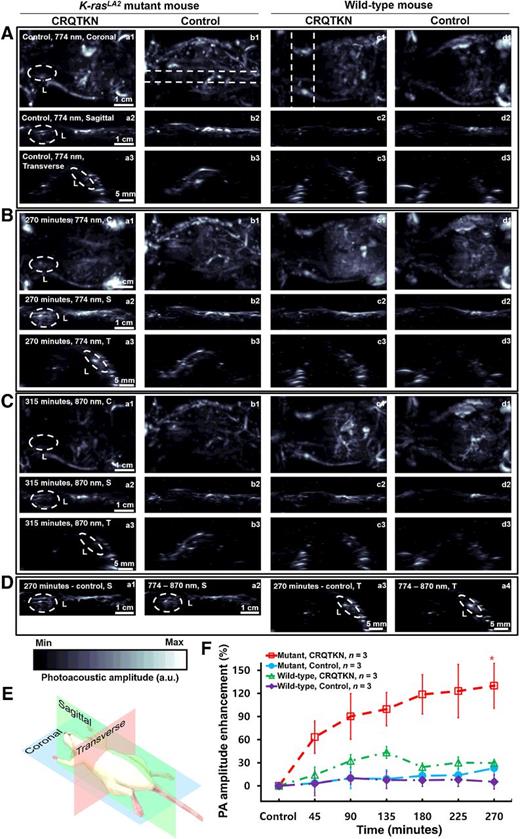 Figure 2. In vivo PAT of lung tumors targeted by the CRQTKN peptide in K-rasLA2 mutant mice. A, PA images at 774 nm before the injection of FPI774-labeled CRQTKN and control peptides into K-rasLA2 mutant and wild-type mice. B, PA images at 774 nm taken 270 minutes postinjection of the peptides into mice. C, PA images at 870 nm taken 315 minutes postinjection of the peptides into mice. D, Subtraction PA images (PA270 min postinjection – PApreinjection) and (PA774 nm – PA870 nm) in the sagittal and transverse imaging planes. E, Imaging planes. F, Quantified PA amplitude enhancement in the regions of interest in tumor-bearing lungs at various time points. *, P < 0.015 (n = 3 per group). Dotted circles indicate the regions of interest in tumor-bearing lungs. C, coronal; S, sagittal; T, transverse; a.u., arbitrary unit.