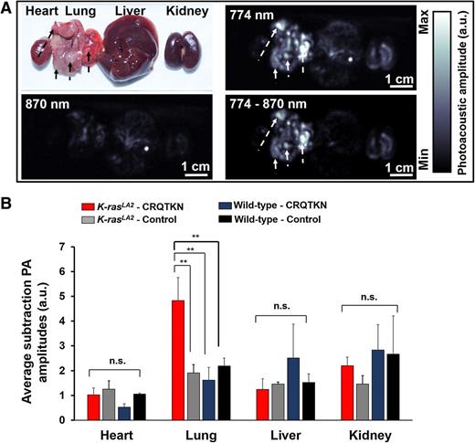 Figure 3. Ex vivo PAT of lung tumors and control organs in K-rasLA2 mutant mice. A, Representative ex vivo PA and spectroscopic PA images at 774 and 870 nm, respectively, and subtraction PA images (PA774 nm – PA870 nm) of lung tumors and control organs (heart, liver, and kidney) isolated from K-rasLA2 mutant mice after injection with FPI774-labeled CRQTKN peptide. Arrows, regions of interest in the tumor-bearing lungs. B, Average subtraction PA amplitudes of lung tumors and control organs (heart, liver, and kidney) isolated from K-rasLA2 mutant and wild-type mice after injection with FPI774-labeled CRQTKN and control peptides (n = 3 per group). a.u., arbitrary unit. **, P < 0.01; n.s., not significant.