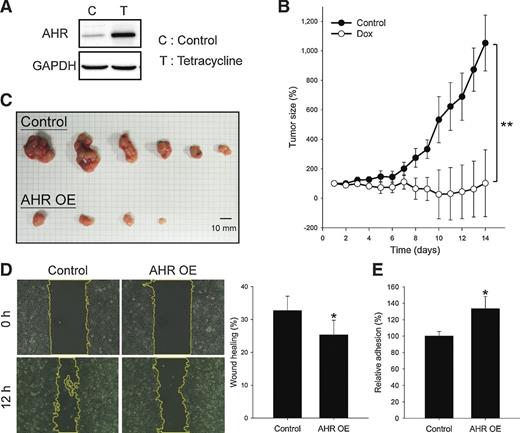 Figure 2. Overexpression of AHR suppresses neuroblastoma tumor progression. A, AHR protein expression was examined in AHR-inducible stNB-V1-AI cells by immunoblotting after 24 hours of tetracycline (10 ng/mL) induction. B, AHR-inducible stNB-V1-AI cells were xenotransplanted in a mouse xenograft model. Tumor-inoculated mice were treated daily with doxycycline (n = 6) in the drinking water (2 g/L) or vehicle control (n = 6). Tumor growth was measured daily for 14 days. Error bars, SEM. C, Tumor-inoculated mice were sacrificed after 14 days of treatment. Tumors from each mouse are shown in the photograph. OE, overexpression. D, Wound healing assays were conducted on AHR-inducible stNB-V1-AI cells that had been treated with 10 ng/mL tetracycline for 24 hours. Yellow dotted lines indicate the wound borders. E, Cell adhesion assays were conducted on AHR-inducible stNB-V1-AI cells that had been treated with 10 ng/mL tetracycline for 24 hours. *, P < 0.05; **, P < 0 0.01.