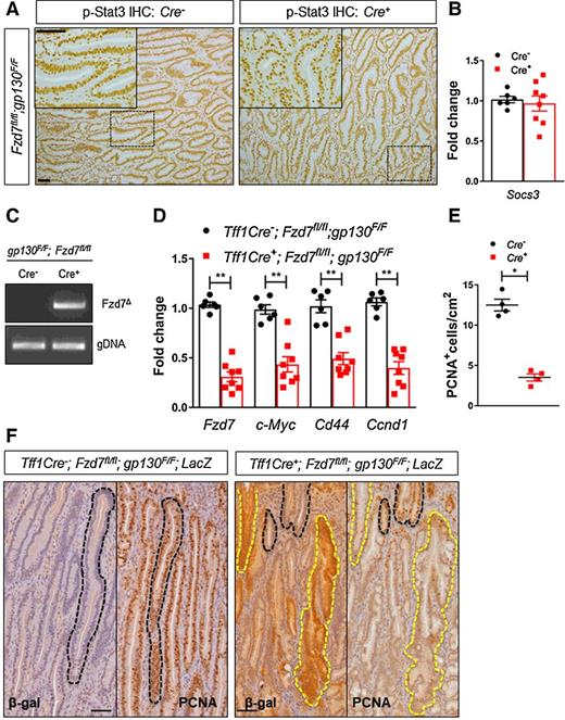 Figure 4. Deletion of Fzd7 from gastric tumors decreases cell proliferation. A, IHC for p-Stat3 on adenoma sections from Fzd7fl/fl;gp130F/F mice (Cre− or Cre+) 30 days after tamoxifen treatment. Scale bars, 100 μm. B, qRT-PCR for Socs3 on gastric adenomas from mice described in A (*, P < 0.05; mean ±SEM; n = 4 mice; Mann–Whitney). C, Conventional PCR to detect recombination of Fzd7fl/fl allele (Fzd7Δ) in gastric adenomas from mice described in A. D, qRT-PCR for Wnt target genes in gastric adenomas from mice described in A (**, P < 0.005; mean ± SEM; n = 7 mice; Mann–Whitney). E, Quantification of PCNA+ cells from adenoma sections described in A (*, P < 0.05; mean ± SEM; n = 3 mice; Mann–Whitney). F, Representative IHC images for β-galactosidase (detecting allelic recombination) and PCNA (proliferation) on serial sections from Tff1Cre−;Fzd7fl/fl;gp130F/F;LacZ or Tff1Cre+;Fzd7fl/fl;gp130F/F;LacZ mice 30 days following tamoxifen. Note, yellow dashed lines demarcate areas of allelic recombination, which correspond to reduced proliferation and black dashed lines represent areas of nonrecombined cells. Scale bars, 100 μm.
