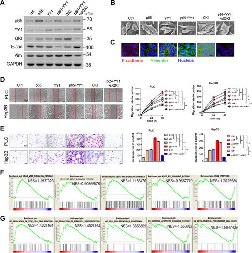 Figure 3. YY1 and p65 promote EMT, migration, and invasion by targeting QKI. A, Expression of E-cadherin and vimentin transfected with YY1, p65, and QKI or cotransfected with QKI siRNA. B, Morphological changes in PLC-PRF-5 cells transfected with YY1, p65, and QKI or cotransfected with QKI siRNA observed with SEM. C, Representative immunofluorescence images of E-cadherin and vimentin of PLC-PRF-5 cells treated in the same manner as in the wound-healing assay. D, Migration of PLC-PRF-5 cells transfected with YY1, p65, and QKI or cotransfected with QKI siRNA. E, Cell invasion assays performed in PLC-PRF-5 cells transfected with YY1, p65, and QKI or cotransfected with QKI siRNA. F, GSEA and KEGG analyses of the enriched expression of YY1 target gene sets after YY1 overexpression in PLC-PRF-5 cells (red, YY1; blue, control). G, GSEA and GO analyses on the enriched expression of YY1 target gene sets after YY1 overexpression (red, YY1; blue, control). Data are presented as means ± SD. *, P < 0.05; **, P < 0.01.