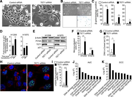 Figure 3. TET1 overexpression prevents NSCLC cells from cellular senescence and genomic instability. H1299, H1975, and H226 cells were transfected with control versus TET1 siRNA and assessed for morphology (A) and activity (B) of β-galactosidase using microscopy and β-galactosidase activity assay (scale bar, 100μm; representative images for H1299 shown). C, Percentage of cells positive for β-galactosidase was calculated. Levels of p21 mRNA were quantified 72 hours and 96 hours after transfection of H1299 and H1975 cells with control versus TET1 siRNA (D), and TET1 and p21 protein was detected 96 hours after transfection (E). The level of DNA double-strand breaks was assessed in H1299 and H1975 cell lines 72 hours after transfection with control versus TET1 siRNA using the micronuclei assay (F), H1299 cells were also analyzed for DNA strand breaks using the comet assay (G), and for DNA damage response activation associated with γH2AX translocation using immunofluorescence (H). I, The percentage of cells positive for γH2AX foci was calculated. Ingenuity Pathway Analysis was used to identify pathways differentially expressed in adenocarcinoma (AdC) and SCC tumors from TCGA characterized by TET1high versus TET1low gene expression (J and K). Results are presented as an average of three experiments ± SEM. *, P < 0.05; **, P < 0.01; ***, P < 0.001.
