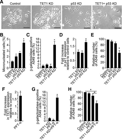Figure 4. Depletion of WT p53 expression or function sensitizes cells to TET1 knockdown (KD)–induced cellular senescence. A549 cells were transfected with control, TET1, p53, or TET1 + p53 siRNAs. A, Analysis of cell morphology using microscopy was performed 120 hours after transfection. B, Assessment of DNA double-strand breaks was performed using micronuclei assay 72 hours after transfection. Detection of β-galactosidase activity (C) and analysis (D) of p21 mRNA levels were performed 120 hours and 96 hours after transfection, respectively. E, Number of cells was assessed 120 hours after transfection. F, In chemical p53 inhibition experiments, A549 cells were incubated with 30 μmol/L of pifithrin-α (PTF-α) for 48 hours and analyzed for TET1 mRNA. Cells cultured with pifithrin-α and transfected with control versus TET1 siRNAs were analyzed for β-galactosidase activity (G) and for cell number (H) 120 hours after transfection. Experiments were performed in triplicate and are presented as mean ± SEM. *, P < 0.05.