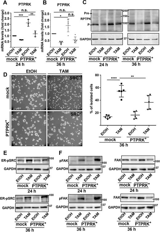 Figure 4. Forced PTPRK expression restores the ability of tamoxifen (TAM)-treated MCF10A-ER-SRC cells to aggregate. A and B, PTPRK mRNA levels normalized to GAPDH on extracts from MCF10A-ER-SRC cells expressing mock guide RNA (mock) or PTPRK guide RNA (PTPRK+), treated with EtOH or tamoxifen for 24 (A) or 36 (B) hours. C, Western blots on protein extracts from MCF10A-ER-SRC cells expressing mock guide RNA (mock) or PTPRK guide RNA (PTPRK+) and treated with EtOH or tamoxifen for 24 or 36 hours, blotted with anti-RPTPK or anti-GAPDH. Pre and P indicate the precursor and P subunit of RPTPK, respectively. D, Phase-contrast images of MCF10A-ER-SRC expressing mock guide RNA (mock) or PTPRK guide RNA (PTPRK+) and treated with EtOH or tamoxifen for 36 hours, plated on agar (left). Percentage of isolated MCF10A-ER-SRC cells for each experimental condition (right). E and F, Western blots on protein extracts from MCF10A-ER-SRC cells expressing mock guide RNA (mock) or PTPRK guide RNA (PTPRK+) and treated with EtOH or tamoxifen for 24 or 36 hours, blotted with anti-pSRC (E, top), which revealed ER-pSRC or anti-GAPDH (bottom) or anti-pFAK (F, top left) and anti-GAPDH (bottom left) or anti-FAK (top right) and anti-GAPDH (bottom right). The same extracts were used for comparison between pFAK and FAK levels. Quantifications are presented as mean ± SD. n.s., nonsignificant; *, P < 0.05; **, P < 0.005; ***, P < 0.001; ****, P < 0.0001 (one-way ANOVA).