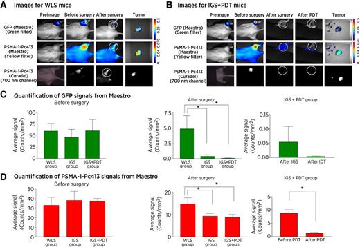 Figure 3. Use of PSMA-1-Pc413 for IGS and PDT. A, Representative images of WLS mice under Maestro and Curadel imaging systems. Circles, surgical bed. B, Representative images of IGS+PDT mice under Maestro and Curadel imaging systems. Minimal amount of GFP and PSMA-1-Pc413 signals was observed in the wound with loss of PSMA-1-Pc413 signal due to photo activation. Circles, surgical bed. C, Quantification of GFP signals in the three experimental groups before surgery (left), after surgery (middle), and after IGS+PDT (right). Before surgery, similar GFP signal was observed in three experimental groups (left). After surgery, significantly lower GFP signal was observed in the IGS and IGS+PDT groups than in the WLS group (*, P < 0.05; middle). Values are mean ± SD (n = 5 animals for WLS and IGS; n = 8 for IGS+PDT). D, Quantification of PSMA-1-Pc413 signals in the experimental groups before surgery (left), after surgery (middle), and after IGS+PDT (right). After surgery, a significant difference was observed between IGS/IGS+PDT and WLS group (middle; *, P < 0.05). Within the IGS+PDT group, PDT further reduced PSMA-1-Pc413 signal significantly as compared with after IGS alone (right). Values are mean ± SD (n = 5 for WLS and IGS, n = 8 for IGS+PDT).