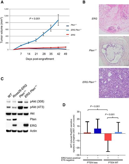 Figure 1. ERG suppresses PI3K signaling, constraining tumorigenesis. A, Rosa26-ERG (n = 10), Pten−/− (n = 10), and Rosa26-ERG Pten−/− (n = 10) prostate organoids were injected into the flanks of SCID mice and tumor volumes were measured weekly. Error bars, SD from the mean. B, Histology (200×) of in vivo specimens from the prostate organoids at the end of study. C, Prostate organoids were generated from wild-type, Rosa26-ERG, Pb-Cre Ptenlox/lox, and Pb-Cre Rosa26-ERG Ptenlox/lox mice and Western blot analysis was performed demonstrating expression of ERG, loss of Pten, and repressed PI3K signaling in organoids overexpressing ERG (experiment run in triplicate). D, Analysis of the TCGA profiling data set demonstrating that ERG-positive human primary prostate cancers are significantly correlated with a repressed AKT gene signature and loss of PTEN results in activation of this signature.