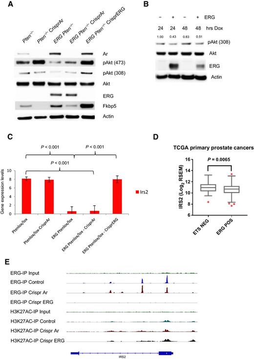 Figure 2. PI3K repression is ERG dependent and ERG suppresses IRS2 transcriptionally. A, Using the Crispr/Cas9 technology, AR and ERG were knocked-out from our Pten−/− and Rosa26- ERG Pten−/− prostate organoids and protein lysates were analyzed by Western blotting. As predicted, knockout of AR in the setting of Pten loss robustly activated PI3K signaling. Surprisingly, though, knockout of AR in the setting of ERG expression had minimal effect on PI3K signaling, whereas knockout of ERG increased pAkt levels profoundly (experiment run in triplicate). B, Acute doxycycline (Dox)-induced overexpression of ERG in wild-type prostate organoids versus vector control demonstrated repression of PI3K signaling, which correlated with ERG expression levels (experiment run in triplicate; quantification of pAkt normalized to actin and Akt). C, mRNA expression of IRS2 was significantly repressed by ERG in our prostate organoids. Three independent lines for each genotype were analyzed. Error bars, SD from the mean. D, Analysis of IRS2 expression in the TCGA data set revealed that prostate cancers harboring ERG genomic rearrangements have a significantly repressed IRS2 expression. E, ChIP-seq analysis demonstrated that ERG binds to the transcription start site of IRS2.