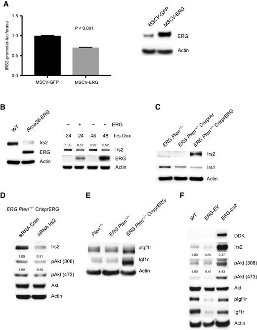 Figure 3. ERG suppression of downregulation of IRS2 mediates IGF1R:PI3K signaling repression. A, 293T cells transfected with IRS2-promoter-firefly luciferase construct with vector control or ERG coexpression demonstrated repressed promoter activity in the setting of ERG. Experiment performed in triplicate. Error bars report SD from the mean and were normalized to Renilla luciferase. Western blot analysis demonstrating ERG overexpression in the 293T cells. B, Acute doxycycline (Dox)-induced overexpression of ERG in wild-type prostate organoids versus vector control demonstrated a decrease in IRS2 levels, which correlated with ERG expression (experiment run in triplicate; quantification of Irs2 normalized to actin). C, IRS2 protein levels are repressed in Rosa-26 ERG Pten−/− organoids and knock-out of ERG is associated with a robust increase in IRS2 levels (experiment run in triplicate). D, siRNA knockdown of IRS2 following Crispr ERG in the Rosa26- ERG Pten−/− organoids reduced pAkt levels (experiment run in triplicate; quantification of pAkt normalized to actin and Akt). E, ERG Pten−/− organoids demonstrate reduced phosphorylation and total levels of Igf1R that were increased following ERG knockout (experiment run in triplicate). F, Prostate organoids derived from Rosa26-ERG mice demonstrate reduced IRS2 levels and repression of pIgf1r and PI3K signaling. Overexpression of IRS2 in Rosa26-ERG prostate organoids increases pIgf1r and PI3K signaling (experiment run in triplicate; quantification of pAkt normalized to actin and Akt).