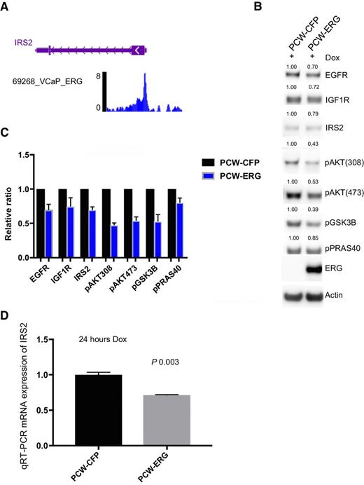 Figure 4. Validation of ERG repression of IRS2-RTK signaling in human model systems. A, In silico ChIP-seq analyses in the prostate cancer ERG-positive cell line VCaP demonstrated significant enrichment for ERG binding at the IRS2 promoter region. Representative read peaks of ERG binding in the IRS2 transcription start site region. B, Doxycycline (Dox)-inducible overexpression of ERG (24 hours) in human normal prostate organoids demonstrated reduced levels of IRS2, total EGFR, total IGF1R, and downstream PI3K phosphorylation of AKT, GSK3B, PRAS40. Experiment performed in triplicate, representative Western blot analysis is shown, and quantification of proteins normalized to actin. C, Bar graph representing mean and SD for protein quantification across three independent experiments of ERG overexpression in human normal prostate organoids, normalized to control. D, IRS2 mRNA levels were significantly repressed following acute overexpression of ERG (24 hours) in human normal prostate. Experiment performed in triplicate, and mean and SD reported.