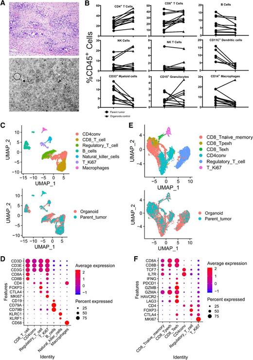 Figure 1. HGSC organoid co-cultures accurately mimic the parent tumors from which they were derived. A, Organoid co-cultures (bottom) physically resemble the diverse cellular environment of the parent tumor (top), which includes cancer, stromal, and immune cells. The co-cultures contain tumor spheres (white arrow), clusters of single immune and stromal cells (black circle), and psammoma body calcifications (black arrow). B, Flow cytometry analysis for all immune cell types was performed on parent tumors and control-treated organoids. Comparisons of each individual immune cell type between parent tumor (circles) and control-treated organoid co-culture (triangles) as a percentage of viable CD45+ cells are shown. C–F, scRNA-seq analysis results comparing the parent tumor and treated organoid co-cultures for patient 20-11. C, UMAPs are shown here to demonstrate concordance across all immune cell types between the parent tumor and organoid co-culture. All populations detected are shown on top with a color key on the right, and an overlay of these populations in the parent tumor (blue) and organoid co-cultures (orange) is shown below. D, Markers (y-axis) used to define each of the individual immune cell populations (x-axis) in C are shown here along with the expression level in each defined cell type. The average expression level (colors) is shown in the percentage of cells (sphere) expressing each marker for each cell type. E, UMAPs are shown here to demonstrate concordance across all T-cell types between the parent tumor and organoid co-culture. All populations detected are shown on top with a color key on the right, and an overlay of these populations in the parent tumor (blue) and organoid co-cultures (orange) is shown below. F, Markers (y-axis) used to define each of the different T-cell populations (x-axis) in E are shown here along with the expression level in each defined cell type. The average expression level (colors) is shown in the percentage of cells (sphere) expressing each marker for each cell type. CD8_Tnaïve_memory, naïve and memory CD8 T cells; CD4conv, conventional nonregulatory CD4 T cells; regulatory_T_cell, regulatory CD4 T cells; T_Ki67, proliferating T cells; CD8_Texh, terminally exhausted CD8 T cells; CD8_Tpexh, progenitor-exhausted CD8 T cells.