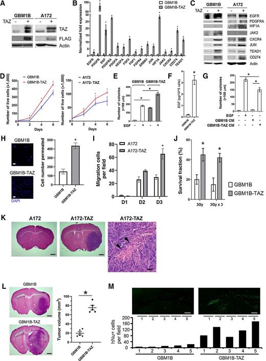 Figure 6. Enforced TAZ expression promotes GBM-associated malignant phenotypes. A, GBM1B and A172 cells were infected with lentiviruses harboring TAZ (FLAG-tagged) cDNA or no cDNA insert as the control to established stable cell lines. Transgene expression was measured by Western blotting. B and C, Validated TAZ-Up genes were analyzed by qRT-PCR (B) in GBM1B and GBM1B-TAZ cells, and by Western blotting (C) using whole cell lysates from GBM1B and A172 cells with ± enforced TAZ expression. D, Cell growth curves were drawn from the number of trypan blue–stained GBM1B and A172 cells with ± enforced TAZ expression. E, Colony formation was quantified in GBM1B and GBM1B-TAZ cells in medium with ± EGF for 10 days. F, GBM1B with ± enforced TAZ expression were grown in medium without growth factors for 48 hours, and EGF release in medium was measured by ELISA. G, GBM1B cells were grown in soft agar with EGF-containing medium or EGF-free conditioned medium (24 hours) from GBM1B and GBM1B-TAZ cells. Colony formation after 10 days was quantified. H, GBM1B and GBM1B-TAZ cells were plated onto laminin-coated Transwell membranes. Cell migration was compared after 24 hours by quantifying DAPI+ cells per field. I, A172 and A172-TAZ cells were subjected to scratch wound healing assay to quantify migrating cells in the scratch area as shown in Supplementary Fig. S7. J, GBM1B and GBM1B-TAZ cells received ± irradiation (one or three daily doses of 3 Gy). Clonogenic survival was quantified and normalized to untreated control cells. K, A total of 10,000 viable A172 and A172-TAZ cells were transplanted into mouse brains (n = 5). Coronal brain sections (20 μm, with hematoxylin and eosin staining) are shown [post-implantation day 76; bar, 0.5 mm (left) and 50 μm (right); arrowhead, necrotic area]. L and M, A total of 10,000 viable GBM1B and GBM1B-TAZ cells were transplanted into mouse brains (n = 5). Coronal brain sections (20 μm, with hematoxylin and eosin staining) are shown (day 60 post implantation; bar, 0.5 mm) with tumor size quantification (L). hNu immunostaining (M) was used to detect and quantify tumor cells invading the contralateral corpus callosum area (marked by black rectangles in L). hNu+ cell numbers were quantified in five fields with equal sizes as marked underneath the picture (bar, 100 mm). Data are represented as mean ± SEM. *, P < 0.01.