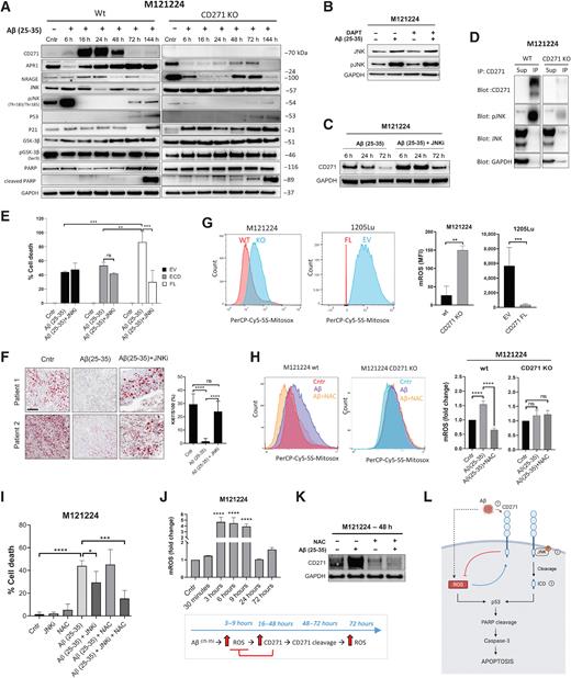 Figure 7. Melanoma cell death is triggered by Aβ(25–35)-mediated activation of CD271–JNK pathway and mitochondrial ROS production. A, Western blot on melanoma cells were treated with Aβ(25–35) (40 μmol/L) at different time points. CD271 and GAPDH belong to the same Western blot shown in Fig. 6B. B and C, M121224 wt cells were treated with Aβ(25–35) (40 μmol/L) ± DAPT (200 nmol/L) or JNKi (SP600125; 300 nmol/L) and Western blot was performed. D, M121224 wt and CD271 KO cells were treated for 48 hours with Aβ(25–35) (40 μmol/L). Lysates were pulled-down with CD271 Ab, and supernatant (Sup) and immunoprecipitates (IP) were immunoblotted with different Abs. E, Melanoma cells were treated with Aβ(25–35) (40 μmol/L) ± JNKi (SP600125; 200 nmol/L) for 1 hour and stained with PI. The percentage of cell death was evaluated by FACS. Two-way ANOVA was used for statistical analysis. **, P < 0.01; ***, P < 0.001.F, Tumor slices were treated for 5 days and stained with Ki67 and S100 Abs. Ki67+ cells were quantified by QuPath. The average of 10 areas was normalized to the total S100. Two-way ANOVA was used for statistical analysis. ****, P < 0.00001. Scale bar, 100 μm. “Cntr” are the same pictures shown also in Fig. 3 (patient 2 and 3). G, Cells were stained with MitoSOX (5 μmol/L) and the levels of mROS were measured by FACS. Data represent the mean ± SD of triplicate determinations. One-way ANOVA was used for statistical analysis. **, P < 0.01; ***, P < 0.001. H, Melanoma cells were treated with Aβ(25–35) (40 μmol/L) ± NAC (5 mmol/L) for 72 hours and stained with MitoSOX. mROS were measured by FACS. I, M121224 were treated with Aβ(25–35) alone or in combination with JNKi (200 nmol/L) ± NAC (5 mmol/L). Cells were stained with PI and the percentage of cell death was evaluated by FACS. One-way ANOVA was used for statistical analysis. *, P < 0.05; ***, P < 0.001; ****, P < 0.00001. J, M121224 cells were treated with Aβ(25–35) and mROS were measured by FACS at different time points. K, M121224 CD271+ cells were treated with Aβ(25–35) (40 μmol/L) ± NAC (5 mmol/L) for 48 hours. CD271 levels were evaluated by Western blot. L, Graphical representation of CD271–JNK–ROS pathway induced following Aβ(25–35) treatment. ns, nonsignificant.