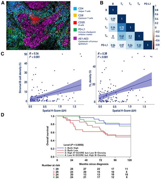 Figure 6. High intratumor heterogeneity is associated with increased TIL density and improved survival in TNBC patients. A, MxIF of primary TNBC tissue cores stained with a panel of antibody markers for each TIL subtype and the tumor epithelium. B, Correlation matrix between specific TIL subsets assessed in primary TNBC tumors. Boxes show the degree of correlation between immune markers. B, B-cell density; Tc, cytotoxic T-cell density; Th, helper T-cell density; Tr, regulatory T-cell density; PD-L1+, programmed death ligand 1 positive cell density. The degree of correlation is represented by the color's intensity. The Pearson correlation coefficient (R) is indicated in each square, with P values below each coefficient. Colocalization was determined through counts of each immune cell across all tumors examined. C, Correlation between the H-score and all B lymphocytes or the general TIL population in primary TNBC with R and P values. Regression line with 95% confidence interval is included. D, Kaplan–Meier survival curve of 105 patients with primary TNBCs assessed on the basis of degree of B lymphocyte density and intratumor heterogeneity. Medians for both the B-cell density and the H-score were used to evenly distribute patients into four cohorts of high and low intratumor heterogeneity or B-cell density.
