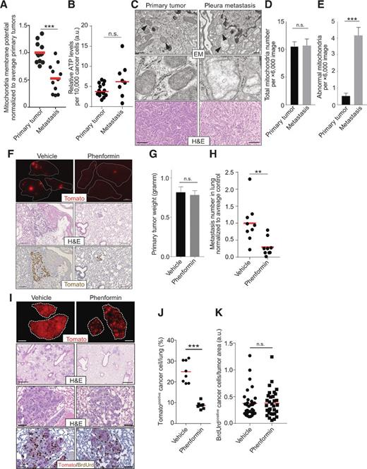 Figure 5. Mitochondria of metastasis in in vivo mouse models of lung cancer have reduced functionality and are a target for antimetastatic treatment. A, Mitotracker deep red analysis by flow cytometry of Lineagenegative;DAPIpositive cells sorted from primary tumors and metastasis in KrasG12D;Trp53KO;R26Tomato lung cancer mice (n = 5 mice) shows significantly reduced membrane potential in metastasis cells compared with primary tumor cells (P < 0.001). Cell number staining artifacts were controlled for by spiked in GFP+ cells as staining control. Each dot represents one primary tumor or one metastasis sample; the red line indicates the mean. B, Analysis of ATP levels by reversed CellTiter-Glo assay of Lineagenegative;DAPIpositive cells sorted from primary tumors and metastasis in KrasG12D;Trp53KO lung cancer mice (n = 3 mice) shows no significant difference in ATP levels between primary tumor and metastasis cells. Each dot represents one primary tumor or metastasis sample. C–E, Electron microscopy analysis of tissue sections from primary tumors and pleura metastasis in KrasG12D;Trp53KO lung cancer mice (n = 2). Mitochondria in metastasis tissue samples show destroyed morphology with less density and bridging [C, top, ×2,000 resolution; middle, ×6,000 resolution; bottom, corresponding hematoxylin an eosin (H&E) staining; top, error bars, 400 nm; bottom, error bars, 100 μm]. Quantification of total number of mitochondria in EM sections (D) shows no significant (P = 0.5455) difference between sections from primary tumors and metastasis, but a significantly higher (P < 0.0001) number of abnormal mitochondria in metastatic tissue sections (E). Error bars, SEM. At least 15 pictures per sample were analyzed. F–H, Mice were subcutaneously injected with a metastatic lung cancer cell line and treated with either phenformin (100 mg/kg orally; n = 9 mice) or vehicle control (n = 9 mice) daily starting 7 days after injection. F, Twenty-one days after injection, lungs were harvested and analyzed by fluorescent stereomicroscope (top, scale bar, 1 mm), hematoxylin and eosin staining (middle, scale bar, 100 μm), and IHC for Tomato (bottom, scale bar, 100 μm). Although primary tumor weight was not significantly different between treated and control animals (P = 0.86; G), the number of metastasis in the lungs was significantly reduced upon phenformin treatment (P = 0.0025; H). Each dot represents one sample; the red line indicates the mean. I–K, 579DLN Met cells were pretreated in vitro with phenformin (200 μmol/L) or vehicle control for 48 hours and then intravenously injected into recipient mice. Mice were then treated with either phenformin (100 mg/kg orally; n = 8 mice) or vehicle control (n = 8 mice) daily starting at the day of injection. I, Eight days after injection, lungs were harvested and analyzed by fluorescent stereomicroscope (top, scale bar, 1 mm), hematoxylin and eosin staining (I, second row, scale bar, 500 μm; third row, scale bar, 50 μm), and IHC for Tomato and BrdUrd (bromodeoxyuridine; bottom, scale bar, 50 μm) and flow cytometry (J). The percentage of Tomatopositive cancer cells in the lungs was significantly reduced upon pretreatment with phenformin (P = 0.0002). Each dot represents one sample; the red line indicates the mean. K, Quantification of BrdUrd-positive cancer cells normalized to tumor area. Not significant, n.s., P = 0.7338. Each dot represents one analyzed random IHC image; four images per mouse were analyzed; the red lines indicate the mean. n.s., not significant; *, P < 0.05; **, P < 0.01; ***, P < 0.001.