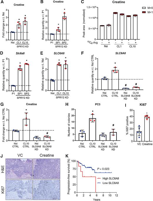 Figure 2. Creatine availability affects proliferation of prostate cancer cells and is increased upon PTEN and SPRY2 deficiency. (A and B) Relative cellular creatine levels in (A) human and (B) murine prostate cancer cells (n = 3 independent experiments; mean values ± SD are shown; *, P < 0.05 compared with Nsi and P1, respectively; unpaired t test). C, Intracellular abundance of creatine isotopes (M+0, M+1) in PC3 cells (Nsi, CL1, and CL10) after 24-hour incubation in the presence of unlabeled arginine or 13C6-arginine (data from single experiment with 3 technical replicates per condition; mean values ± SD). D, Relative levels of creatine transporter, Slc6a8 mRNA in murine prostate cancer cells (data shown are from a single representative experiment, performed three times with 3 technical replicates each; mean values ± SD are shown; *, P < 0.05 compared with P1; 1-way ANOVA with Dunnett multiple comparison test). E, Relative levels of creatine transporter, SLC6A8 in human prostate cancer cells (n = 3 independent experiments; mean values ± SD are shown; *, P < 0.05 compared with Nsi; 1-way ANOVA with Dunnett multiple comparison test). F, Relative levels of SLC6A8 mRNA in PC3 Nsi and SPRY2 KD CL10 with SLC6A8 KD (n = 3 independent experiments; mean values ± SD are shown; *, P < 0.05 compared with Nsi CTRL & #P < 0.05 compared with respective CTL cells; 1-way ANOVA with Tukey multiple comparison test). G, Relative cellular creatine levels in PC3 Nsi and SPRY2 KD CL10 with SLC6A8 KD (n = 3 independent experiments; mean values ± SD are shown; *, P < 0.05 compared with Nsi CTRL & #P < 0.05 compared with respective CTL cells; 1-way ANOVA with Tukey multiple comparison test). H, Number of soft agar colonies of PC3 Nsi and SPRY2 KD CL10 with SLC6A8 KD (n = 3 independent experiments; mean values ± SD are shown; *, P < 0.05 compared with Nsi CTRL & #P < 0.05 compared with respective CTRL cells; 1-way ANOVA with Dunnett multiple comparison test). I, IHC quantification of Ki67 in prostate tumors from Ptenpc-/- Spry2pc-/- mice treated for 2 months with vehicle (VC) or 1% creatine (n = 5 mice for each group; mean values ± SD are shown; *, P < 0.05; Mann–Whitney test). J, Representative H&E and Ki67 images of prostate tumor sections from Ptenpc-/- Spry2pc-/- mice treated for 2 months with vehicle (VC) or 1% creatine. (n = 5 mice for each group; scale bar = 100 μm). K, Kaplan–Meier plot for progression‐free survival in MSKCC, Cancer Cell 2010 (24) prostate cancer dataset showing cases with high (more than z-score = 1.8; n = 6) or low (less than z-score = 1.8; n = 74) expression of SLC6A8; log‐rank Mantel-Cox test.