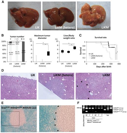 Figure 1. Hepatocyte-specific Mdm2 deletion in LiK (KrasG12D mutation specifically in the liver) mice promoted the development of liver tumors. Hepatocyte-specific KrasG12D-mutant mice (KrasLSL-G12D/+ Alb-Cre; LiK (KrasG12D mutation in the liver) mice) and Mdm2-floxed mice were mated to generate hepatocyte-specific Mdm2-knockout KrasG12D mice. After the mating of Mdm2fl/+ Kras+/+Alb-Cre mice and Mdm2fl/+ KrasLSL-G12D/+ mice, the phenotypes of the following offspring groups were analyzed at 4 months of age (A, B, D) or subjected to survival analysis (C); (1) KrasG12D Mdm2+/+ (LiK) (Mdm2+/+ KrasLSL-G12D/+ Alb-Cre); (2) KrasG12D Mdm2+/del (Mdm2fl/+ KrasLSL-G12D/+ Alb-Cre; LiKM [KrasG12D mutation and Mdm2 loss in the liver)-hetero mice]; and (3) KrasG12D Mdm2del/del (Mdm2fl/fl KrasLSL-G12D/+ Alb-Cre; LiKM mice) littermates. A, Macroscopic appearance of the livers. B, Macroscopic tumor number, maximum tumor diameter, and liver to body weight ratio (N = 10–21 per group). C, Kaplan–Meier survival analysis (N = 12–14 per group). D, H&E staining in the liver (×100). Arrowheads indicate tumors. LiKM mice were mated with ROSA26-LacZ mice, and the KrasG12D Mdm2del/del ROSA26-LacZ offspring mice were sacrificed at 4 months of age (E–F). E, β-Galactosidase staining of the liver (×100, left; and ×200, right). F, Genotyping of the Mdm2 gene in tumorous (T) and nontumorous (NT) tissues in KrasG12D Mdm2del/del ROSA26-LacZ mice. Tissue DNA was extracted from both tumorous and nontumorous liver tissues collected via laser microdissection after β-galactosidase staining. The DNA band was separated by electrophoresis after PCR. *, P < 0.05.