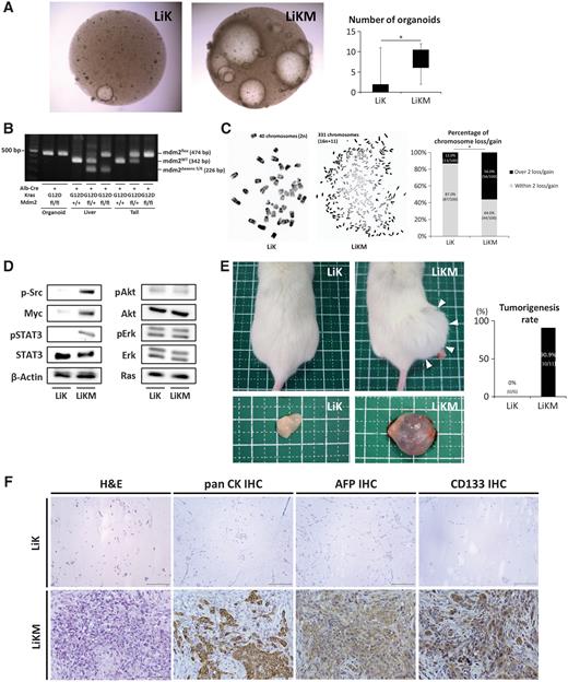 Figure 4. HPC-derived organoids generated from LiKM mice showed tumor-formation ability in an allograft model. Organoids were generated from 0.50 g liver samples in LiK and LiKM mice. A, Representative pictures and numbers of organoids larger than 200 μmol/L 10 days after isolation from the livers (N = 7 per group). B, PCR of the DNA isolated from the organoids, whole livers, and tails of the indicated genotypes and specimens. C, Karyotyping of organoid-consisting cells (N = 100 per group). Two lines of organoids were generated in each genotype. Fifty cells were examined for karyotyping in each line. D, Protein expression in organoids. Organoids were inoculated into NOG mice for allografts (E and F). E, Macroscopic appearance of mice 21 days after organoid inoculation and the tumorigenesis rate. Arrowheads indicate the allograft. F, H&E staining and IHC for pan CK, AFP, and CD133 in allografts (×400). *, P < 0.05.