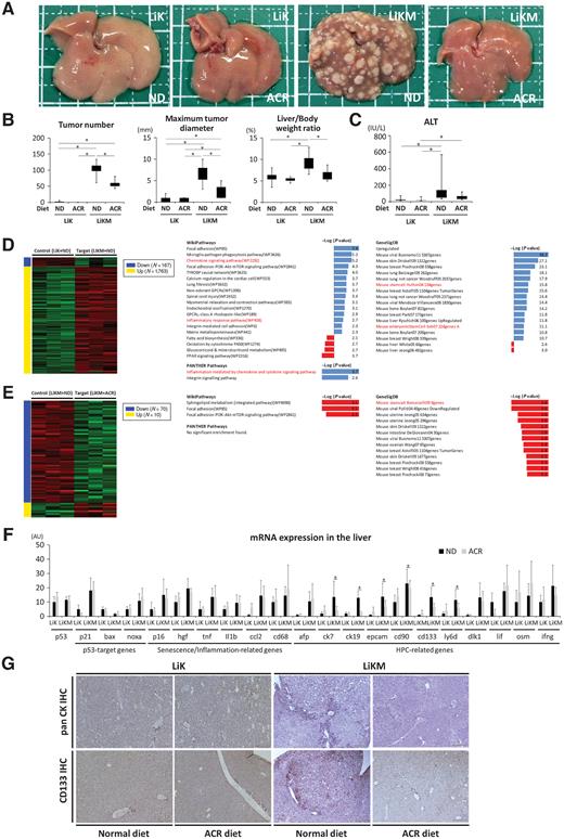 Figure 5. ACR inhibited HPC expansion and suppressed tumorigenesis in LiKM mice. LiK and LiKM mice were fed a normal diet (ND) or a diet containing 0.06% ACR from 5 weeks of age until sacrifice at 4 months of age. A, Representative images of the livers. B, Macroscopic tumor number, maximum tumor diameter, and liver to body weight ratio (N = 14–17 per group). C, Serum ALT (N = 7–17 per group). D and E, RNA-seq of the liver tissues in LiK and LiKM mice (N = 3 per group). Total RNA was extracted from nontumorous liver tissues at 4 months of age. Heatmap of DEGs and enrichment analysis between LiK and LiKM mice fed a normal diet (D) and LiKM mice fed a normal or ACR diet (E). Pathways noted in red showed inflammation- or stem cell–related pathways (F). mRNA expression in the liver (N = 5–14 per group). G, IHC for pan CK and CD133 in the liver (×100). *, P < 0.05.