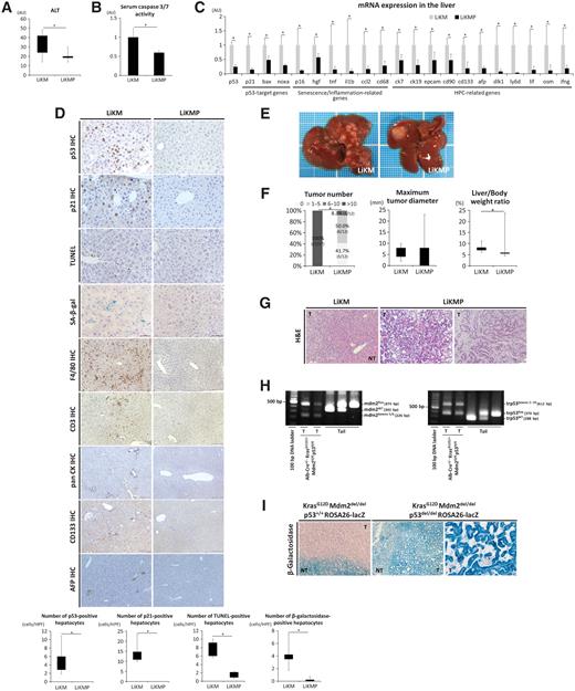 Figure 6. Concurrent deletion of hepatocyte p53 suppressed hepatocyte apoptosis and SASP, HPC expansion, and development of HCC in LiKM mice. LiKM mice and p53-floxed mice were mated to generate hepatocyte-specific Mdm2 and p53-double knockout KrasG12D mice. After mating p53fl/+ Mdm2fl/+ Kras+/+Alb-Cre mice and p53fl/+ Mdm2fl/+ KrasLSL-G12D/+ mice, the KrasG12D Mdm2del/del p53+/+ (p53+/+ mdm2fl/fl KrasLSL-G12D/+ Alb-Cre; LiKM mice) and KrasG12D Mdm2del/del p53del/del (p53fl/fl mdm2fl/fl KrasLSL-G12D/+ Alb-Cre; LiKMP (KrasG12D mutation and Mdm2/p53 double loss in the liver) mice) offspring littermates were sacrificed at 6 weeks (A–D) or 4 months (E–H) of age. LiKMP mice were mated with ROSA26-LacZ mice to generate KrasG12D Mdm2del/del p53+/+ ROSA26-LacZ and KrasG12D Mdm2del/del p53del/del ROSA26-LacZ mice and were sacrificed at 4 months of age (I). A, Serum ALT (N = 6–9 per group). B, Serum caspase 3/7 activity (N = 7–8 per group). C, qPCR analysis of the mRNA expression in whole liver tissue (N = 6–9 per group). D, IHC for p53 (×400), p21 (×400), F4/80 (×200), CD3 (×200), pan CK (×100), CD133 (×100), and AFP (×100), as well as TUNEL staining (×400) and SA-β-gal staining (×400) of the liver and the number of positive hepatocytes. E, Macroscopic images of the livers. F, Macroscopic tumor number, maximum tumor diameter, and liver to body weight ratio in the Mdm2-KO groups (N = 12–34 per group). G, H&E staining of the liver tissues in LiKM mice and LiKMP mice (left, poorly differentiated tumor; right, cholangiocellular carcinoma; ×200). H, Genotyping of the trp53 and mdm2 genes in liver tumors in 4-month-old LiKMP and control mouse tail samples. I, β-Galactosidase staining of the livers of KrasG12D Mdm2del/del p53+/+ ROSA26-LacZ and KrasG12D Mdm2del/del p53del/del ROSA26-LacZ mice (left, poorly differentiated tumor; right, cholangiocellular carcinoma; ×200). The picture of cholangiocellular carcinoma in KrasG12D Mdm2del/del p53del/del ROSA26-LacZ mice was obtained from a female mouse. I, *, P < 0.05.