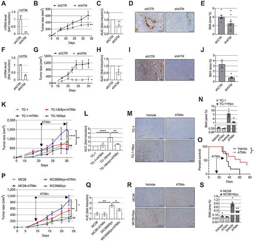 Figure 5. Targeting ATM in myofibroblasts reduces their intratumoral accumulation and slows tumor growth. A and F, qRT-PCR showing shRNA ATM knockdown in HFFF2 (A) or TGFβ1-treated MLF (myoMLF; F) prior to injection in mice (ntr = 3; SD shown). B, G, C, and H, Tumor growth curves (B and G) and AUC histograms (C and H) following coinjection of tumor cells with shCTR or shATM fibroblasts (5PT cells + HFFF2, B and C; TC-1 cells + myoMLF, G and H). Data from single experiments are presented; mouse numbers = 3–8 (B and G). Two-way ANOVA is used for AUC analysis of three individual experiments for both 5PT (C) and TC-1 models (H). D and I, Representative SMA IHC from the experiments shown in B and G, respectively. E and J, Quantification of SMA staining (ntr = FoV = 3) from the experiments shown in B (E) and G (J). K, L and P and Q, Mice injected with either TC-1 ± myoMLF (K and L) or MC38 ± TGFβ1-treated MCF (myoMCF; P and Q) were treated with ATM inhibitor AZD0156 for the duration of the experiment (mouse number = 5–8); tumor growth curves (K and P); AUC analysis of two experiments relative to K (two-way ANOVA, L); AUC analysis of the single experiment shown in P (homoscedastic Student t test, Q). M–N and R–S, Representative images and quantification of SMA IHC of mouse tumors in K and P, respectively (ntr = FoV = 3). O, Overall survival of TC-1 + myoMLF mice treated daily with AZD0156 at days 15–28 (mouse number = 11–12; Mantel–Cox log-rank test is shown; see also Supplementary Fig. S5k and S5l). Homoscedastic Student t test is shown in the figure and refers to the control unless otherwise highlighted. Scale bars, 200 μm.