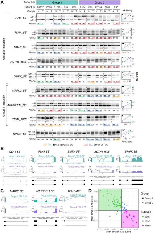 Figure 2. Eight AS events display distinct patterns in two patient groups. A, RT-PCR validation of AS events in gastric tumors (T) and matched normal (N) tissues from 10 patients, using primers that amplify both included and skipped isoforms. For each AS event, a representative gel image is shown along with PSI values, calculated as the percentage of included/(%included + %skipped); significant ΔPSI (T–N) values (n = 3, ΔPSI >|10%| and ΔPSI >|5%|) are colored. Exons included (+) or skipped (−) are annotated (*, bands of no interest). Correlations of ΔPSI values between RT-PCR and RNA-seq experiments are shown on the right. *, P < 0.05; **, P < 0.01; ns, not significant. B and C, Read coverage and junction reads showing inclusion of AS events that define “Group 2” (B) and “Group 1” (C) in gastric tumors. Gene name and AS type are indicated, along with average PSI for tumors. D, Scatter plot of patients using mean(ΔPSI; Group 2 vs. 1). The areas for three subtypes are shown in different background colors—EpiS, green; MesS, magenta; and HybS, white, where the x and y intercepts of linear boundaries are 0.1.