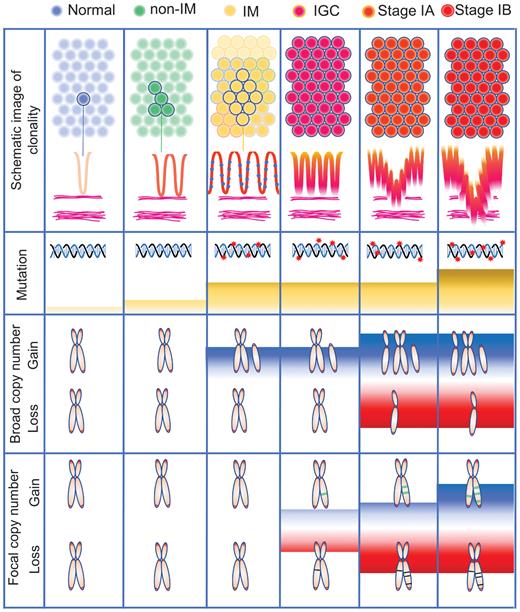 Expansion of Gastric Intestinal Metaplasia with Copy Number Aberrations ...