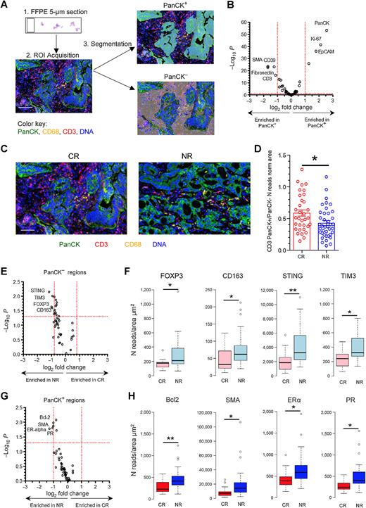 Figure 3. DSP confirms distinct baseline functional immune contexture in EACs of CRs and NRs. A, Experimental design: spatial proteomic profiling of 53 tumor and immune markers was conducted on FFPE EAC biopsy sections; selection of multiple ROIs per tissue sample was based on immunofluorescent staining for PanCK (tumor epithelial marker), CD68 (macrophages), and CD3 (T lymphocytes); nuclei were stained with 4',6-diamidino-2-phenylindole (DAPI). Protein counts were measured within PanCK+-enriched tumor regions (masks) and PanCK− stromal regions (inverted masks). B, Volcano plot of proteins enriched in PanCK+ (n = 72) versus PanCK− (n = 72) areas showing statistical significance for proteins with P < 0.05; P values were calculated using the linear mixed model. C, Representative immunofluorescent staining for PanCK, CD68, and CD3 in tumor tissue from CRs and NRs. Scale bar, 100 μm. D, CD3 PanCK+/PanCK− ratios for each ROI (normalized by area) for CRs and NRs (calculated from DSP reads). *, P <0.05, unpaired t test. E and G, Volcano plots of proteins enriched in PanCK− (E) and PanCK+ (G) areas in tumors from CRs (n = 33 ROIs) versus NRs (n = 39 ROIs), showing statistical significance for proteins with P <0.05; P values were calculated using the linear mixed model. F and H, Corresponding box plots representing read numbers (N) normalized to the area for proteins differentially enriched in PanCK− (F) and PanCK+ areas (H), presented as mean ± SEM. *, P < 0.05; **, P < 0.01, unpaired t test.
