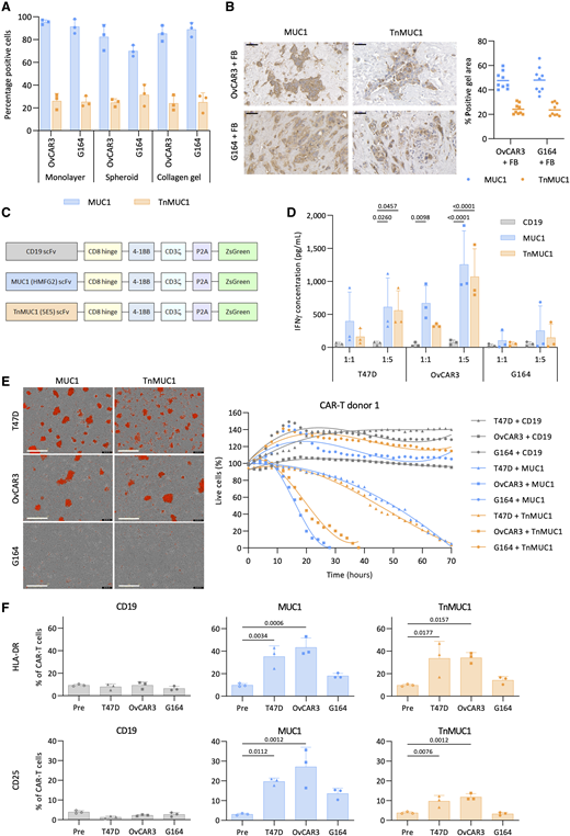 OvCAR3 cells were sensitive but G164 cells were resistant to CAR T-cell cytotoxicity in monolayer cultures. A, Flow cytometry analysis of the expression of MUC1 and TnMUC1 on monolayer, spheroid, and collagen gel cultures of OvCAR3 and G164 cells. Data plotted as mean ± SD of three repeats. B, Expression of MUC1 and TnMUC1 on OvCAR3+FB and G164+FB collagen gels. Data plotted as mean ± SD of three gels per three replicates. Different FB donors were used for each replicate. Scale bars, 50 μm. C, Schematic representation of CD19, MUC1, and TnMUC1 directed second generation CARs. D, ELISA data showing IFNγ concentration after coculturing CAR T cells with monolayers of T47D, OvCAR3, and G164 cells for 2 days at 1:1 and 1:5 T:E ratios. E, Representative images (left) and quantification (right) of Incucyte killing assay in which monolayers of T47D, OvCAR3, and G164 cells were treated with CAR T cells from one donor at 1:5 T:E ratio. Images shown are 3 days after treatment. Red, dead cells. Scale bars, 400 μm. F, Flow cytometry analysis of the expression of T-cell activation markers HLA-DR (top) and CD25 (bottom) pre and 2 days post coculture with monolayers of T47D, OvCAR3, and G164 cells. D and F, Data plotted as mean ± SD for three CAR T-cell donors. Statistics performed using two-way (D) and one-way ANOVA (F).