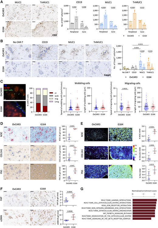 Dense ECM prevented CAR T-cell migration and cytotoxicity in G164/FB collagen gels. A, CD3+ CAR T cells at the peripheral and core regions of OvCAR3/FB and G164/FB collagen gels. Two different CAR T-cell and FB donors were used in this experiment. B, IHC staining and quantification for caspase-3 (Casp3) on OvCAR3/FB and G164/FB collagen gels. C, Behavior of CAR T cells in OvCAR3/FB and G164/FB collagen gels. Representative images from three repeats. Blue, fibronectin; green, CAR T cells; red, EpCAM. Scale bar, 50 μm. Proportion of static (st), wobbling (wob), migrating (mig), and long migrating (Lmig) CAR T cells. Speed and length of movement of wobbling (OvCAR3: 172, G164: 112) and migrating (OvCAR3, 145; G164, 83) CAR T cells. D, Masson’s trichrome (M3C), COL1A1, and fibronectin (FN1) staining and quantification of OvCAR3/FB and G164/FB collagen gels. E, TWOMBLI analysis showing the heatmaps and percentage of HDM for M3C, COL1A1, and FN1 in OvCAR3/FB and G164/FB collagen gels. Scale bar, 100 μm. F, Expression of FAP and αSMA on OvCAR3/FB and G164/FB collagen gels. G, Barplot illustrating significantly enriched canonical pathways (FDR < 0.05) in G164 vs. OvCAR3 cells in monolayer. A, B, D, and F, Data plotted as mean ± SD of three gels per two replicates. Scale bar, 50 μm. Statistics performed using two-way ANOVA (A and B) and unpaired t test (C–F).