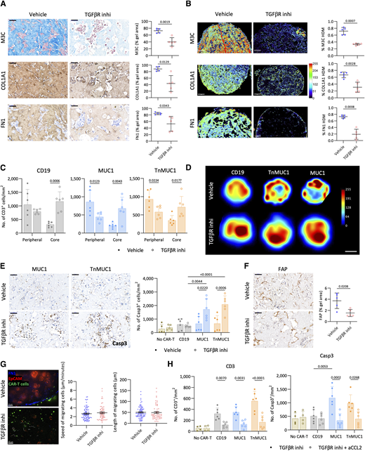Inhibition of TGFβ signaling reduced ECM density and stimulated CAR T-cell activity in G164/FB gels. A, M3C, COL1A1, and FN1 staining and quantification of G164/FB gels treated with TGFβR inhibitor (TGFβR inhi). Scale bar, 50 μm. B, TWOMBLI analysis showing the heatmaps and %HDM for M3C, COL1A1, and fibronectin (FN1) in G164/FB gels treated with TGFβR inhibitor. Scale bar, 100 μm. C, Number of CD3+ CAR T cells at the peripheral and core regions of G164/FB collagen gels treated with TGFβR inhibitor. Two different CAR T-cell and FB donors were used for this experiment. D, Heatmaps generated using Definiens Tissue Studio showing the distribution of CAR T cells in G164/FB collagen gels treated with TGFβR inhibitor. Representative images from two/three gels per two replicates. Scale bar, 500 μm. E, IHC staining and quantification for caspase-3 (Casp3) on G164/FB gels treated with TGFβR inhibitor. Scale bar, 50 μm. F, Expression of FAP on G164/FB gels treated with TGFβR inhibitor. Scale bar, 50 μm. G, Behavior of CAR T cells in G164/FB gels treated with TGFβR inhibitor. Representative images from three repeats. Blue, FN1; green, CAR T cells; red, EpCAM. Scale bar, 50 μm. Speed and length of movement of migrating (vehicle, 83; TGFβR inhibitor, 62) CAR T cells. H, Number of CD3+ (left) and Casp3+ (right) on G164/FB gels treated with TGFβR inhibitor and aCCL2. A–C, E, F, and H, Data plotted as mean ± SD of two/three gels per two replicates. Statistics performed using unpaired t test (A, B, and F) and two-way ANOVA (C, E, and H).