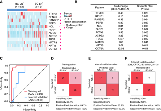 Identification of potential biomarker combinations for classification of BC-LN+ from BC-LN− using machine-learning method. A, Proteins with the highest predictive values in classifying BC-LN+ and BC-LN− samples by ExtraTrees. See Supplementary Table S4. B, ExtraTrees model for the classification of BC-LN+ and BC-LN−. C, Receiver operating characteristic curve of the ExtraTrees-based model in training and internal validation set. D, Classification error matrix of the training set (70%) and test set (30%) for the 12 proteins using the ExtraTrees classifier. The number of samples identified is noted in each box. E, Classification error matrix of the training set (70%) and test set (30%) for the 12 proteins using the ExtraTrees classifier. The number of samples identified is noted in each box. F, Classification error matrix of the external validation set (CPTAC breast cancer cohort, n = 75; ref. 16) for the 12-protein classifier. The number of samples identified is noted in each box.