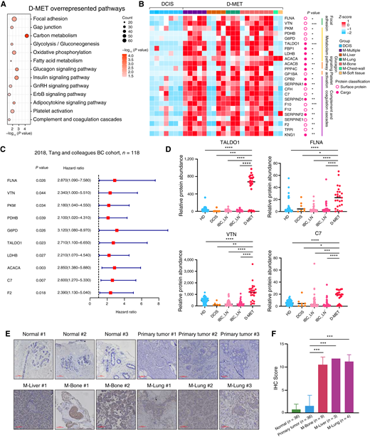 Potential EV survival biomarkers for the distant metastases of breast cancer. A, The bubble plot indicates the overrepresented pathways in D-MET compared with DCIS. See Supplementary Table S5. B, Differentially expressed proteins between distant metastases and DCIS samples. See Supplementary Table S5. C, Potential markers of distant metastasis were significantly associated with clinical outcomes in breast cancer (Tang and colleagues breast cancer cohort, n = 118; ref. 17; P value from log-rank test). D, Specific markers of breast cancer distant metastasis. E, Representative pictures of TALDO1 IHC from normal, primary tumor, and metastatic tissues. Scale bar, 100 μm. F, IHC score of TALDO1 in normal (n = 36), primary tissue (n = 36), M-Bone (n = 9), M-Liver (n = 3), and M-lung (n = 4). Student t test, *, P < 0.05; **, P < 0.01; ***, P < 0.001; ****, P < 0.0001.