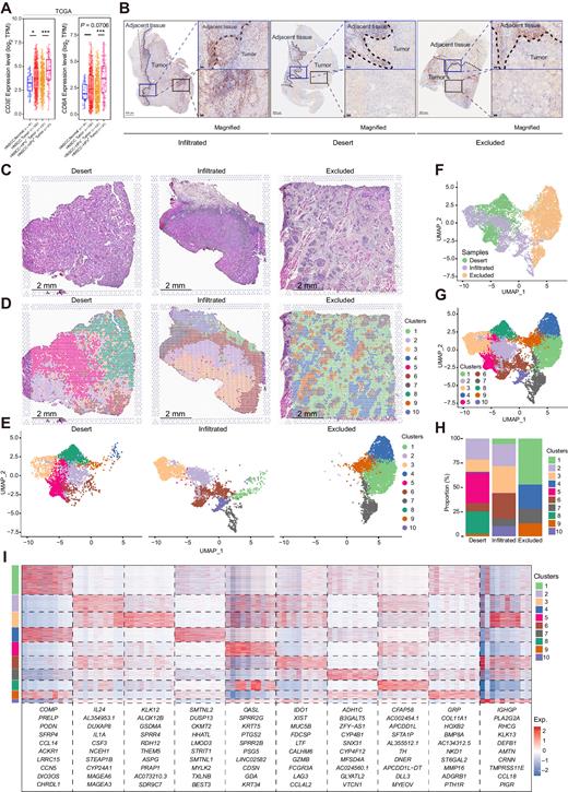 Spatial and Single-Cell Transcriptomics Reveal a Cancer-Associated ...