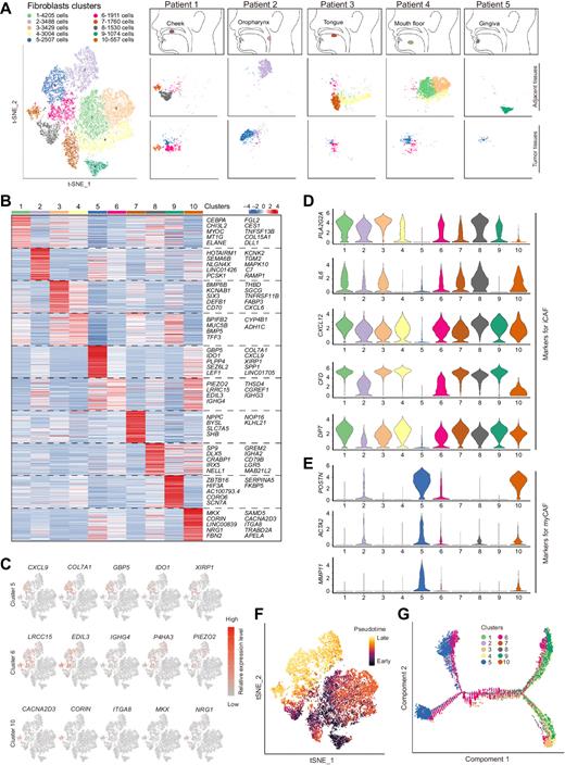 Spatial and Single-Cell Transcriptomics Reveal a Cancer-Associated ...
