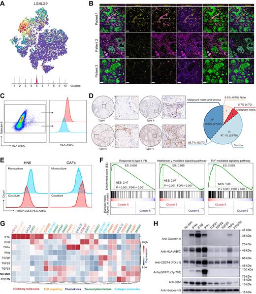 Spatial and Single-Cell Transcriptomics Reveal a Cancer-Associated ...