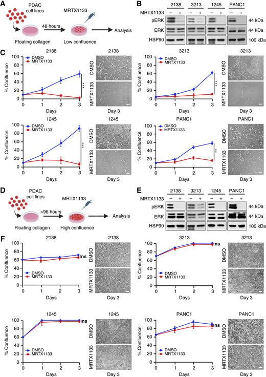 MRTX1133 inhibits the growth of PDAC cells in “low”- but not “high”-confluent collagen cultures. A, PDAC cells (1 × 105) were grown in floating collagen gels (1.2 mg/mL) for 48 hours to generate “low”-confluent cultures. Depiction of “low”-confluent floating collagen cultures. B, PDAC cell lines (2138, 3213, 1245, PANC1) grown in “low”-confluent collagen cultures were treated with MRTX1133 (0.5 µmol/L) for 8 hours, and the effect on ERK1/2 phosphorylation was analyzed by Western blotting. Blots are representative of at least three biological replicates. C, PDAC cell lines grown in “low”-confluent collagen cultures were treated with DMSO or 0.5 µmol/L MRTX1133 for 72 hours. The cells were imaged at baseline and after 1, 2, and 3 days of treatment, and the relative growth was quantified. Error bars, ± SD; n = 3, unpaired t test. **, P < 0.01; ***, P < 0.001. Scale bar, 100 μm. D, PDAC cells (1 × 105) were grown in floating collagen gels (1.2 mg/mL) for 96 to 120 hours to generate “high-confluent” cultures. Depiction of “high-confluent” floating collagen cultures. E, PDAC cell lines grown in “high-confluent” collagen cultures were treated with MRTX1133 (0.5 µmol/L) for 8 hours, and the effect on ERK1/2 phosphorylation was analyzed by Western blotting. Blots are representative of at least three biological replicates. F, PDAC cell lines grown in “high-confluent” collagen cultures were treated with DMSO or 0.5 µmol/L MRTX1133 for 72 hours. The cells were imaged at baseline and after 1, 2, and 3 days of treatment, and the relative growth was quantified. Error bars, ± SD; n = 3, unpaired t test. ns, not significant. Scale bar, 100 μm.
