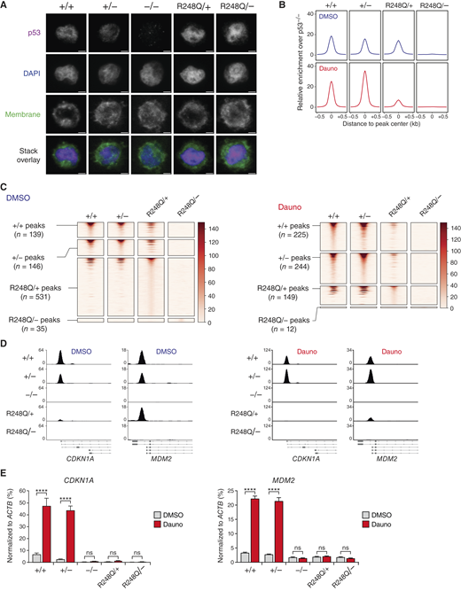 R248Q impairs the ability of WT p53 to bind to promoter DNA and to transactivate expression of target genes. A, Immunofluorescence microscopy images showing p53 (magenta), DAPI (blue), and CellBrite Fix 640 membrane stain (green) in MOLM13-TP53 isogenic AML cell lines treated for 3 hours with 100 nM Dauno (n = 3 independent experiments; one representative example is shown; confocal microscope Leica DMI6000B, 63× objective). Scale bar, 2.5 μm. B, ChIP followed by NGS in isogenic MOLM-TP53 AML cell lines of the indicated genotypes after treatment with DMSO or 100 nmol/L Dauno for 6 hours. Plots show genome-wide relative enrichment of p53 variants (WT or R248Q) over p53null cells over TSS-proximal regions (−10 kb to first intron). C, Tornado plots of WT and R248Q ChIP-seq peaks over TSS-proximal regions (−10kb, first intron with a horizontal window of 1 kb around the peak center) in isogenic MOLM-TP53 AML cell lines of the indicated genotypes. Cells were treated as described in B. Plots show relative enrichment and mutual overlap of the peaks identified in each cell line. D, Representative Integrative Genome Viewer images depicting the ChIP-seq peaks for p53 over the TSS of CDKN1A or MDM2 in isogenic MOLM-TP53 AML cell lines of the indicated genotypes after treatment as described in B. E, Relative expression of CDKN1A and MDM2 transcripts normalized to ACTB in isogenic MOLM-TP53 AML cell lines of the indicated genotypes after treatment with DMSO or 100 nmol/L Dauno for 6 hours (n = 3 independent experiments). Bar graphs represent averages. Error bars, SD. ns, nonsignificant; ****, P ≤ 0.0001, one-way ANOVA, Tukey multiple comparison.