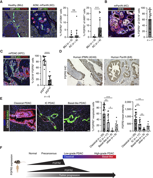 FGFR2 is progressively upregulated in mutant KRAS-driven pancreatic metaplasia, precancerous lesions, and human classical PDAC. A, Left, representative IF for the acinar marker amylase (AMY; white), the ductal marker Dolichos biflorus agglutinin (DBA; green), FGFR2 (red), and DAPI (blue) conducted on healthy pancreata from B6J mice (n = 5) and ADM and mPanINs from KC mice (n = 6). Scale bar, 25 μm. Right, quantification of staining plotted as mean ± SD. Three images per mouse were quantified. Unpaired Student t test. B, Left, representative IF for CK19 (white), FGFR2 (red), and DAPI (blue) conducted on mPanINs from KC mice (n = 7). Scale bar, 25 μm. Right, quantification of staining plotted as mean ± SD. Three images per mouse were quantified. C, Left, representative IF for CK19 (white), p53 (green), FGFR2 (red), and DAPI (blue) conducted on tumors from KPC mice (n = 6). Scale bar, 25 μm. Right, quantification of staining plotted as mean ± SD. Three images per mouse were quantified. Unpaired Student t test. mPDAC, metastatic PDAC. D, Representative IHC for FGFR2 conducted on human IPMN and PanIN1/2 lesions. E, Left, representative IF for FGFR2 (red), GATA6 (white), S100A2 (green), and DAPI (blue) conducted on human PDACs. Scale bars, 25 μm. Samples that present % GATA6+ S100A2- cancerous cells >60 are classified as “classical,” samples with % GATA6- S100A2+ cancerous cells >30 are classified as “basal-like,” and samples with % GATA6+ S100A2+ cancerous cells >5 are classified as “intermediate coexpressor (IC).” Remaining samples that do not meet these criteria are classified as “other.” Right, quantification of staining plotted as mean ± SD. Unpaired Student t test. F, Schematic representation of FGFR2 expression during pancreatic cancer progression in the KRASG12D-driven mouse model and in human samples. ns, not significant; *, P ≤ 0.05; **, P ≤ 0.01; ***, P ≤ 0.001; ****, P ≤ 0.0001.