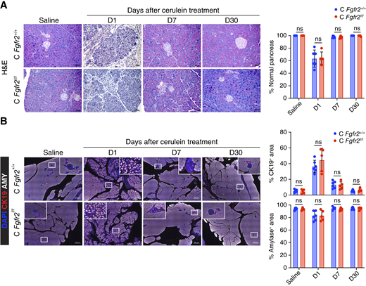 FGFR2 is dispensable for pancreas recovery following injury. A, Left, representative hematoxylin and eosin (H&E) staining conducted on pancreatic samples from C Fgfr2+/+ and Fgfr2f/f mice at different time points after saline or cerulein treatment (day −1, day 0). Scale bar, 50 μm. Right, quantification of the fraction of normal pancreas (n = 5–6). The results show the mean ± SD. Unpaired Student t test. B, Left, representative IF for CK19 (red), amylase (AMY; white), and DAPI (blue) conducted on pancreatic samples from C Fgfr2+/+ and Fgfr2f/f mice at different time points after saline or cerulein treatment (day −1, day 0; n = 5–6). Scale bars are 500 μm for main images and 50 μm for insets. Right, quantification of staining plotted as mean ± SD. Unpaired Student t test. ns, not significant.
