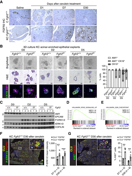 FGFR2 abrogation impedes mutant KRAS-induced transformation of acinar cells by reducing proliferation and MAPK pathway activation. A, Representative IHC for FGFR2 conducted on pancreatic samples from C and KC mice at different time points after saline or cerulein treatment (day −1, day 0). Scale bar, 50 μm. B, Left, representative brightfield images (scale bar, 90 μm), hematoxylin and eosin (H&E) staining (scale bar, 20 μm), and IF for CK19 (green), amylase (AMY; magenta), and DAPI (blue; scale bar, 10 μm) conducted on acinar clusters and associated terminal ductal epithelium from KC Fgfr2+/+ and Fgfr2f/f mice at different time points after culture in collagen. Right, quantification of staining plotted as mean ± SD (n = 5). Unpaired Student t test. C, Protein expression analysis in acinar clusters and associated terminal ductal epithelium from KC Fgfr2+/+ and Fgfr2f/f mice at different time points after culture in collagen, as determined by Western blotting. Loading control, COFILIN. D, GSEA signature “HALLMARK_KRAS_SIGNALING_UP” is increased in acinar-enriched explants from KC Fgfr2+/+ compared with Fgfr2f/f mice at day 2 of culture in collagen. E, GSEA signature “HALLMARK_G2M_CHECKPOINT” is increased in acinar-enriched explants from KC Fgfr2+/+ compared with Fgfr2f/f mice at day 5 of culture in collagen. F and G, Left, representative IF for CLU (yellow), FGFR2 (red), phospho-ERK1/2 (F) or Ki67 (green; G), and DAPI (blue) conducted on pancreatic samples from KC Fgfr2+/+ mice at days 7 and 30 after cerulein treatment (day −1, day 0; n = 5–8). Scale bars, 500 μm for main images and 20 μm for insets. Right, quantification of staining plotted as mean ± SD. Paired Student t test. **, P ≤ 0.01; ***, P ≤ 0.001. NES, normalized enrichment score.